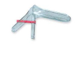 speculum st mono med safety