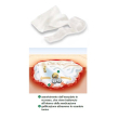 suprasorb a compr.10x10 10pz